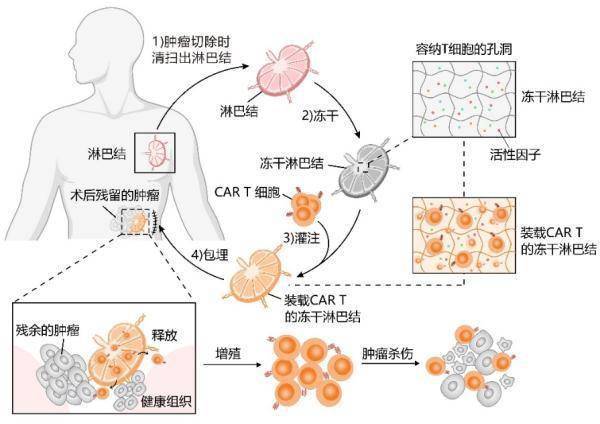 从冻干果蔬找到灵感，浙大科研团队开发肿瘤治疗新方法 (图2)