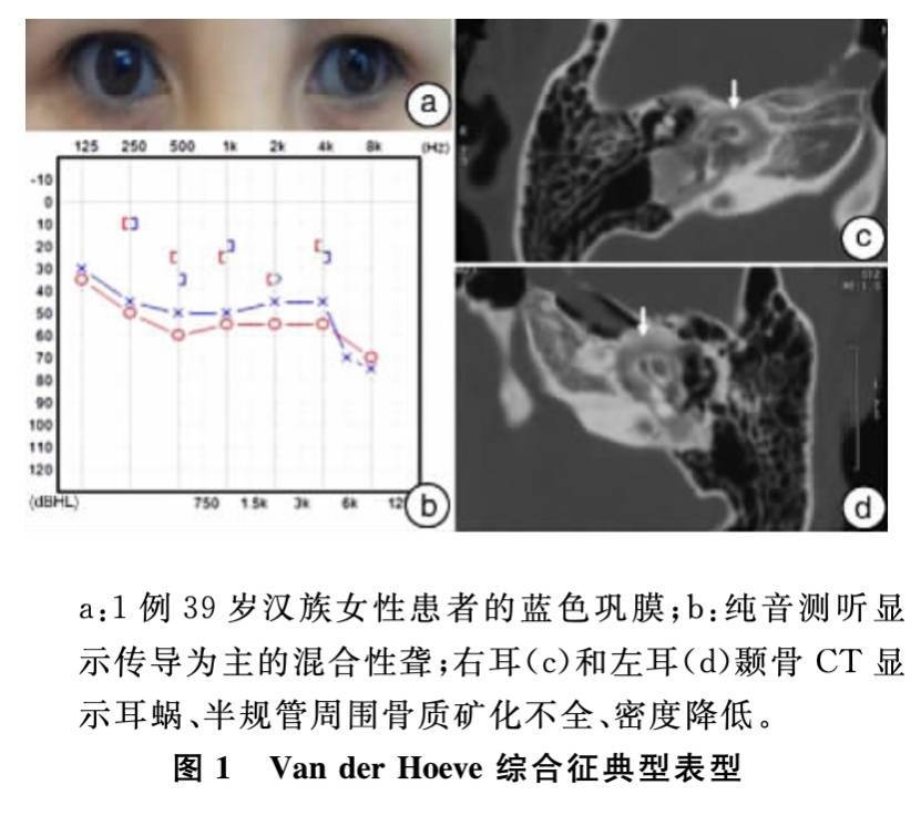 为什么我摘下眼镜，就听不清别人说话了？ (图3)