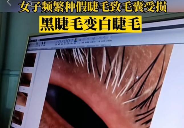 假睫毛暗藏“美丽”隐患 这6点小常识一定要牢记 (pic1) 假睫毛暗藏“美丽”隐患 这6点小常识一定要牢记 (pic1)