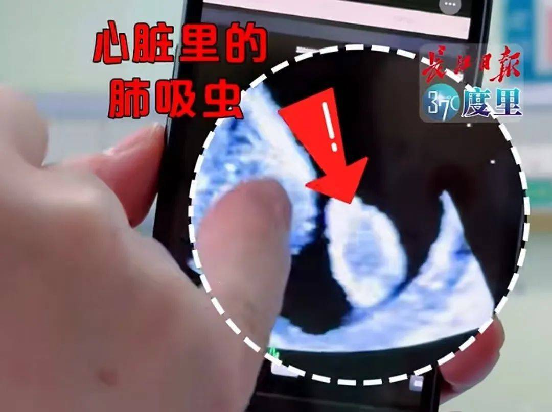 10岁男童被这种虫钻进心脏，画面惊悚！只因3年前一个举动 (pic1)
