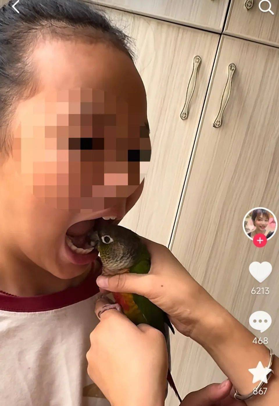 女子用鹦鹉为孩子拔牙,医生:或致感染鹦鹉热、禽流感 (pic1) 女子用鹦鹉为孩子拔牙,医生:或致感染鹦鹉热、禽流感 (pic1)