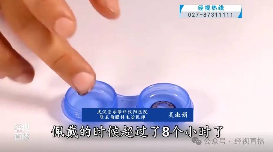 女子戴隐形眼镜20年,角膜长出3毫米新生血管!医生提醒:隔夜佩戴隐形眼镜的风险极高 (pic2) 女子戴隐形眼镜20年,角膜长出3毫米新生血管!医生提醒:隔夜佩戴隐形眼镜的风险极高 (pic2)