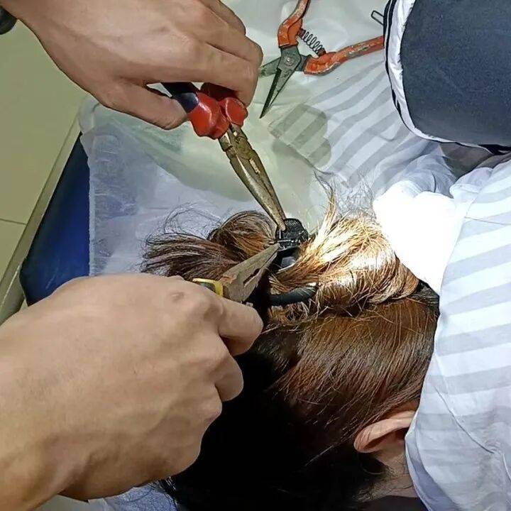 女子睡前没摘发饰,夜里插入耳朵直抵后脑勺!医生:绝非个例! (pic3) 女子睡前没摘发饰,夜里插入耳朵直抵后脑勺!医生:绝非个例! (pic3)