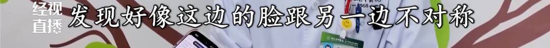 武汉女子一觉醒来脸“歪”了!医生:冬季高发,发病时都有这个表现……紧急提醒 (pic3) 武汉女子一觉醒来脸“歪”了!医生:冬季高发,发病时都有这个表现……紧急提醒 (pic3)