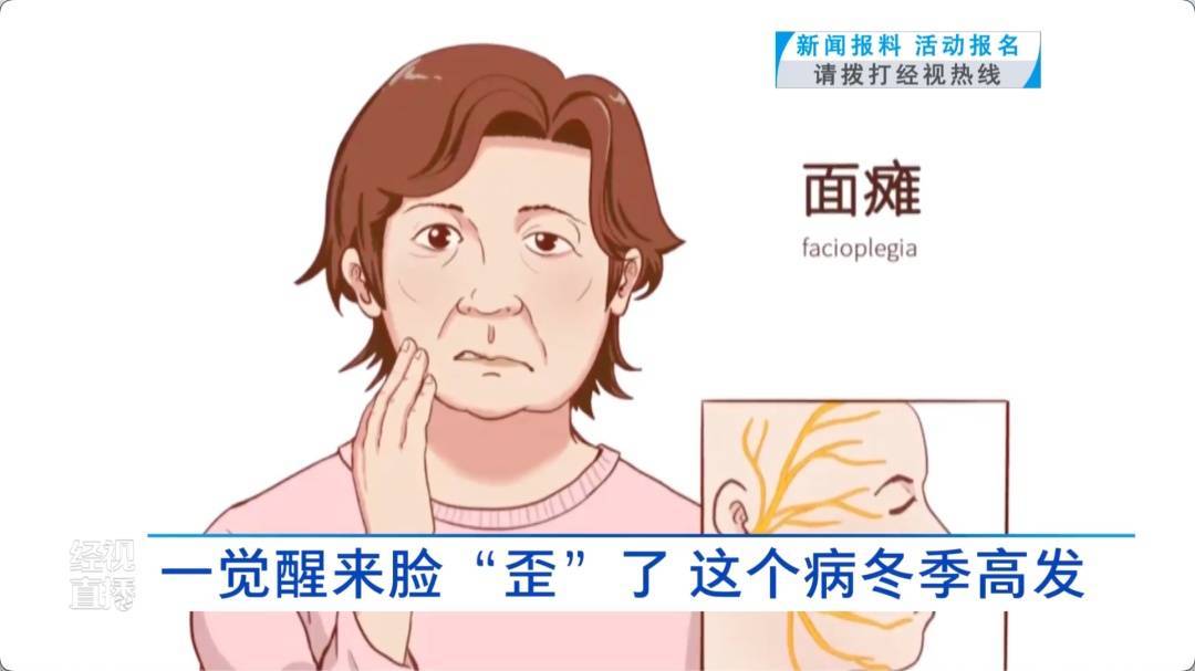 武汉女子一觉醒来脸“歪”了!医生:冬季高发,发病时都有这个表现……紧急提醒 (pic4) 武汉女子一觉醒来脸“歪”了!医生:冬季高发,发病时都有这个表现……紧急提醒 (pic4)