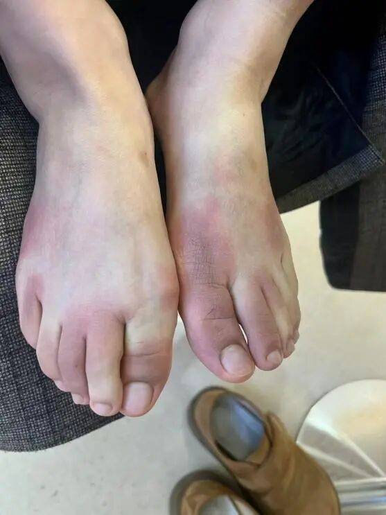 破防了!北方人遭南方过冬暴击,穿满“装备”仍扛不住湿冷,网友:懂这种痛 (pic3) 破防了!北方人遭南方过冬暴击,穿满“装备”仍扛不住湿冷,网友:懂这种痛 (pic3)