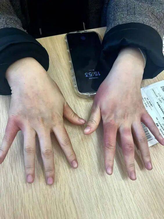 破防了!北方人遭南方过冬暴击,穿满“装备”仍扛不住湿冷,网友:懂这种痛 (pic2) 破防了!北方人遭南方过冬暴击,穿满“装备”仍扛不住湿冷,网友:懂这种痛 (pic2)