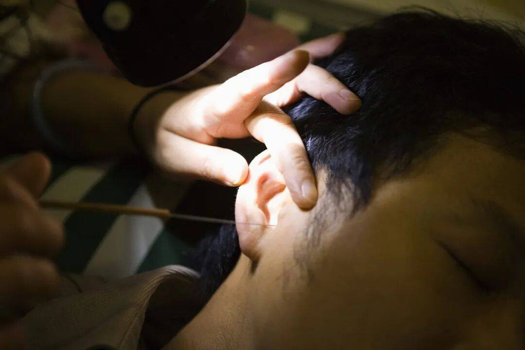 掏耳朵、采耳远比想象中更危险!这些伤害耳朵的行为,你中了几个→ (pic1) 掏耳朵、采耳远比想象中更危险!这些伤害耳朵的行为,你中了几个→ (pic1)