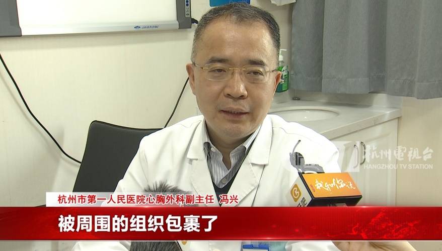 17岁小伙参军体检,发现胸腔内有根5cm缝衣针 (pic4) 17岁小伙参军体检,发现胸腔内有根5cm缝衣针 (pic4)