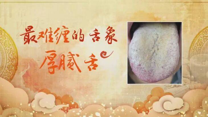 心血管不好的人,舌头会有这种变化!每天一杯羹,化瘀血、护心脏 (pic7) 心血管不好的人,舌头会有这种变化!每天一杯羹,化瘀血、护心脏 (pic7)