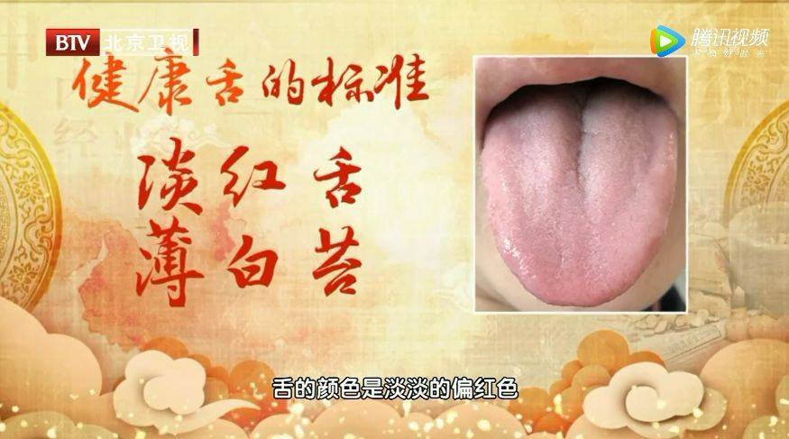 心血管不好的人,舌头会有这种变化!每天一杯羹,化瘀血、护心脏 (pic13) 心血管不好的人,舌头会有这种变化!每天一杯羹,化瘀血、护心脏 (pic13)
