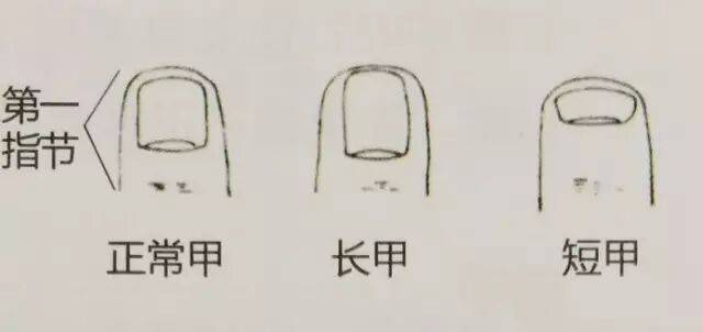 男子手指甲发紫妻子劝他去医院被怼“吃饱了没事干”,几天后老公突然胸痛被120拉走 (pic5) 男子手指甲发紫妻子劝他去医院被怼“吃饱了没事干”,几天后老公突然胸痛被120拉走 (pic5)