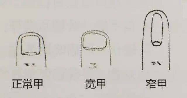 男子手指甲发紫妻子劝他去医院被怼“吃饱了没事干”,几天后老公突然胸痛被120拉走 (pic6) 男子手指甲发紫妻子劝他去医院被怼“吃饱了没事干”,几天后老公突然胸痛被120拉走 (pic6)