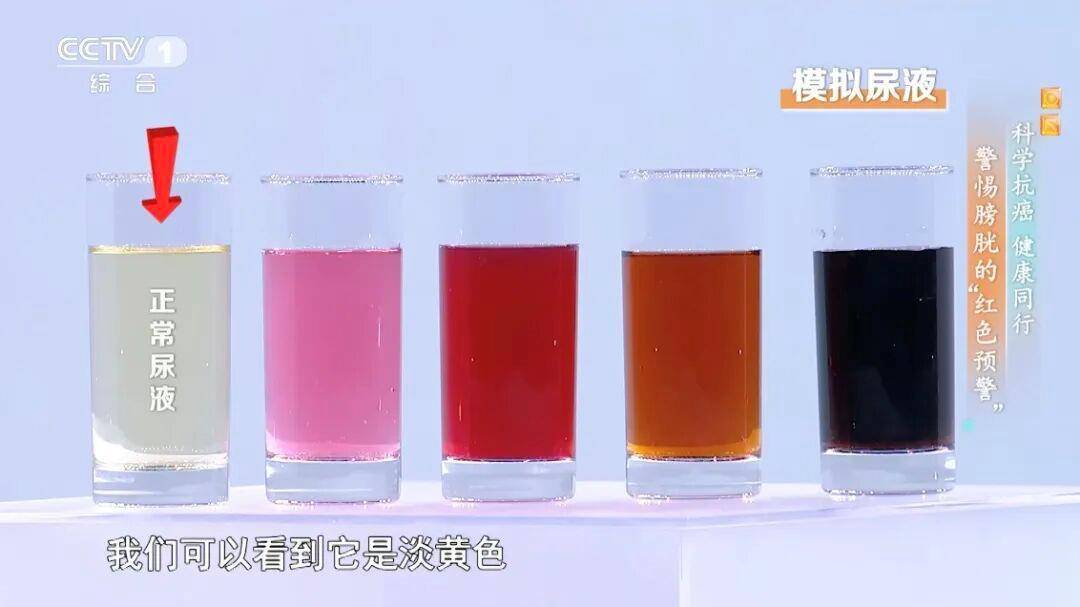 喝水后出现这种异常可能是癌症发出的信号 预防做好这5点→ (pic1) 喝水后出现这种异常可能是癌症发出的信号 预防做好这5点→ (pic1)