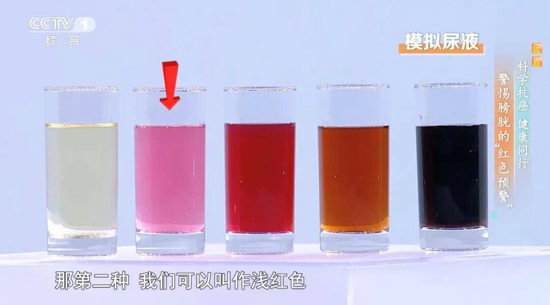 喝水后出现这种异常可能是癌症发出的信号 预防做好这5点→ (pic2) 喝水后出现这种异常可能是癌症发出的信号 预防做好这5点→ (pic2)