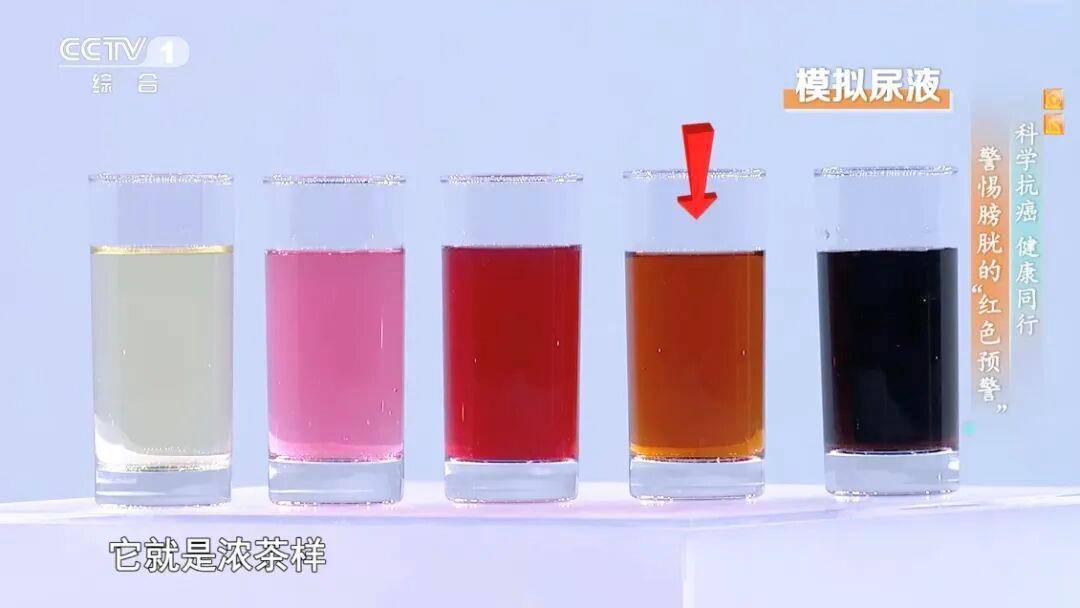 喝水后出现这种异常可能是癌症发出的信号 预防做好这5点→ (pic4) 喝水后出现这种异常可能是癌症发出的信号 预防做好这5点→ (pic4)