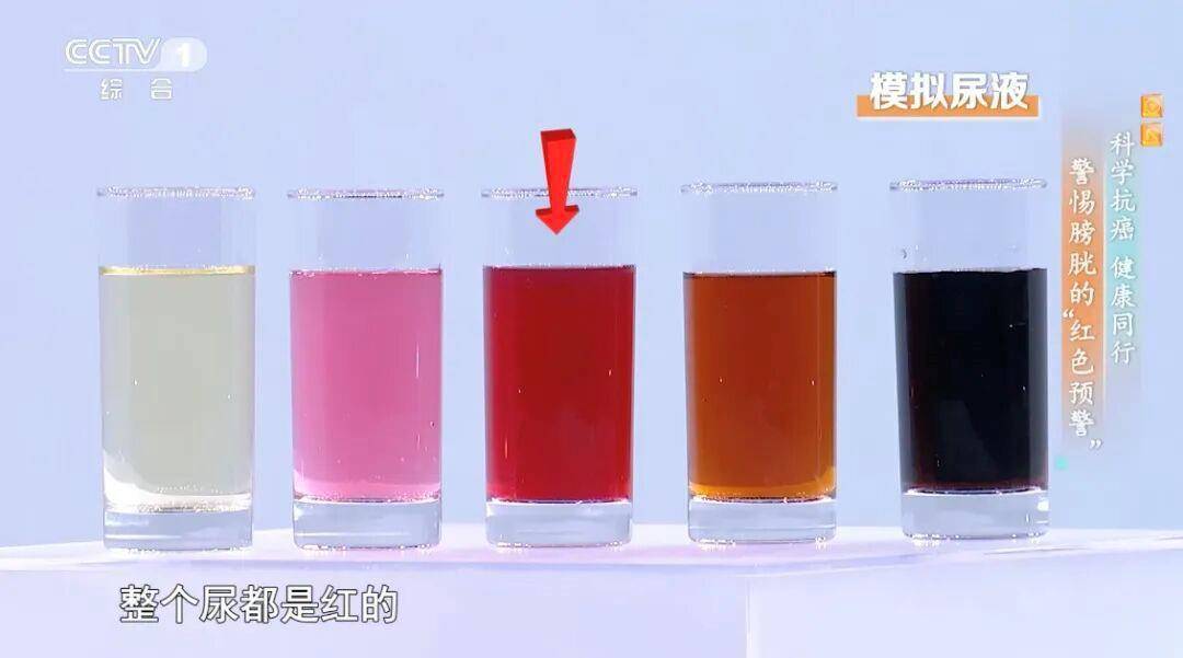 喝水后出现这种异常可能是癌症发出的信号 预防做好这5点→ (pic3) 喝水后出现这种异常可能是癌症发出的信号 预防做好这5点→ (pic3)