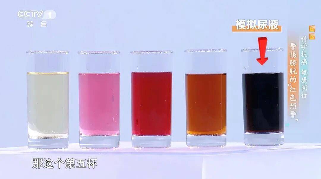 喝水后出现这种异常可能是癌症发出的信号 预防做好这5点→ (pic5) 喝水后出现这种异常可能是癌症发出的信号 预防做好这5点→ (pic5)