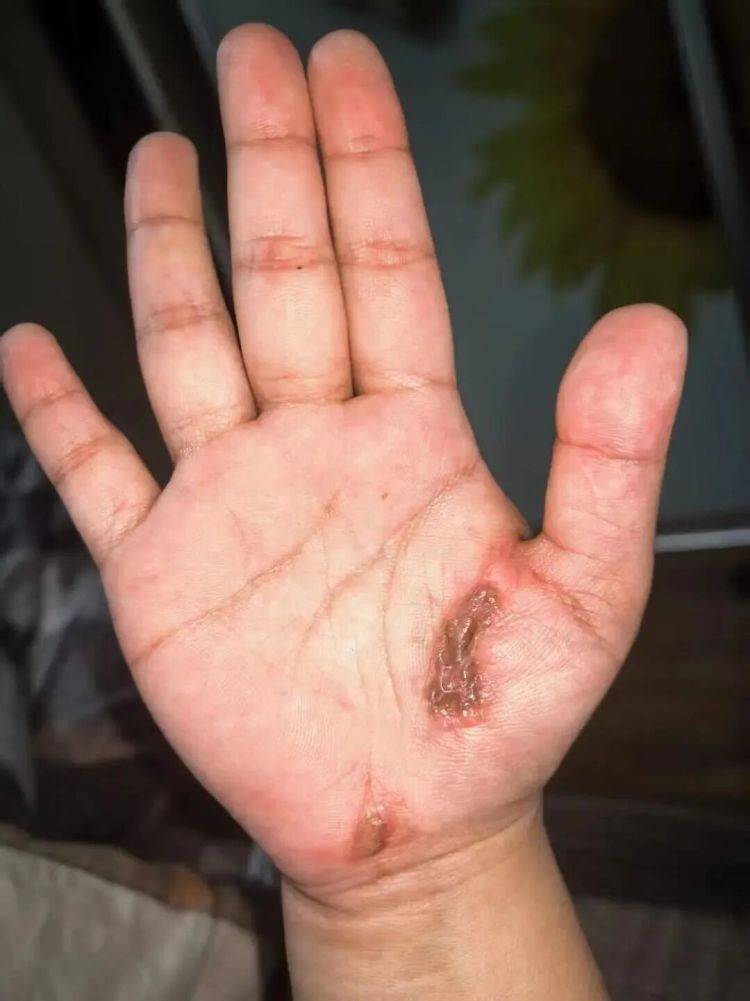 边充电边玩手机竟被电击?这些习惯赶紧改 (pic1) 边充电边玩手机竟被电击?这些习惯赶紧改 (pic1)