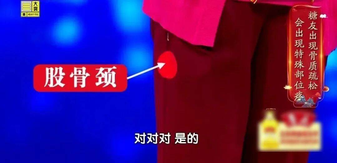 骨质疏松“偏爱”这2类人，认准一个“黄金三角”组合，把钙补到骨头里 (pic3)