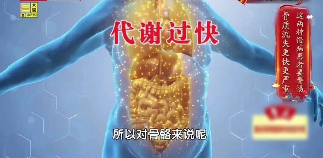 骨质疏松“偏爱”这2类人，认准一个“黄金三角”组合，把钙补到骨头里 (pic6)