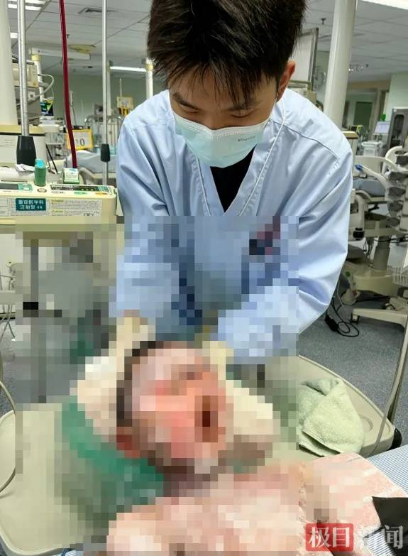 9岁男童全身大面积皮肤剥脱、溃烂,元凶几乎家家都有! (pic1) 9岁男童全身大面积皮肤剥脱、溃烂,元凶几乎家家都有! (pic1)