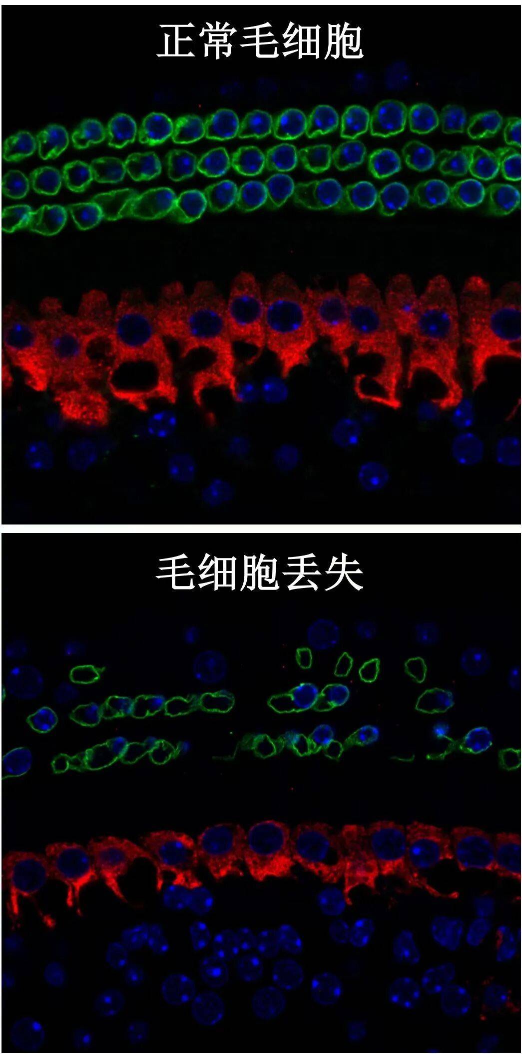 大学生戴耳机入睡,耳机在耳朵里爆炸:非“杂牌”,此前未出现异常 (pic5) 大学生戴耳机入睡,耳机在耳朵里爆炸:非“杂牌”,此前未出现异常 (pic5)
