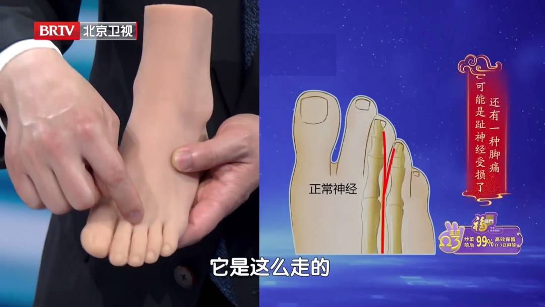 走路多了脚疼不正常?医生:这种疼可能是神经在报警,两个小妙招,轻松护足 (pic14) 走路多了脚疼不正常?医生:这种疼可能是神经在报警,两个小妙招,轻松护足 (pic14)